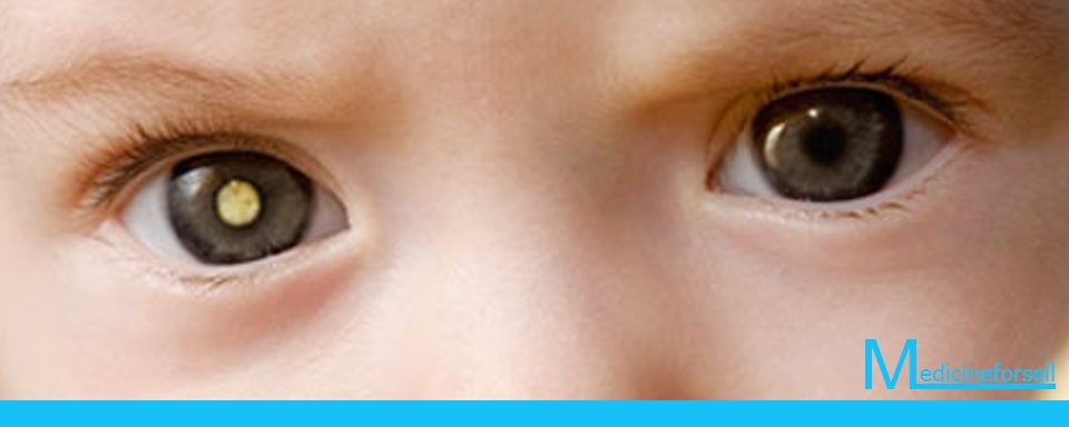 ما هو مرض PHPV للعين؟