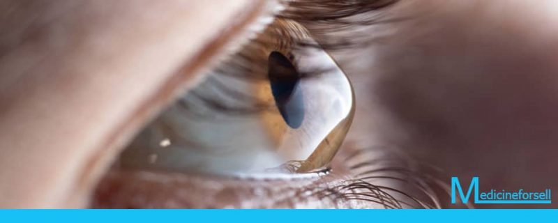التهاب القرنية و الملتحمة أو حساسية العين خلال فصل الربيع