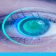 مضاعفات عملية الليزك للعيون