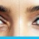 10 طرق للتخلص من الهالات السوداء حول العينين