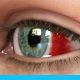 نزف تحت الملتحمة (وعاء دموي مكسور في العين): الأعراض, التشخيص والعلاج