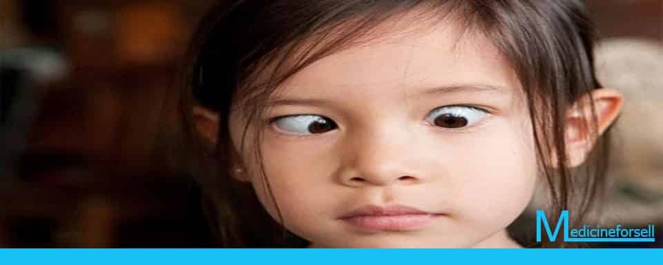 اسباب الانحراف في العين عند الاطفال