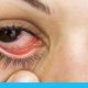 أنواع مضاعفات العين و العناية بالعين ضدها