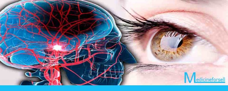 رؤية هذه الأعراض في العين يجب أن يشتبه في الإصابة بالسكتة الدماغية والسكري!