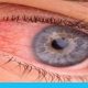 احمرار العين: متى يصبح علامة خطر وكيف يمكن تجنبه؟