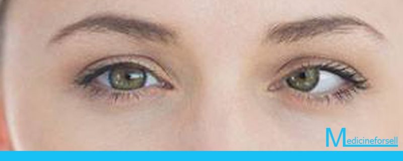 العين الكسولة (الغمش): الأعراض والأسباب