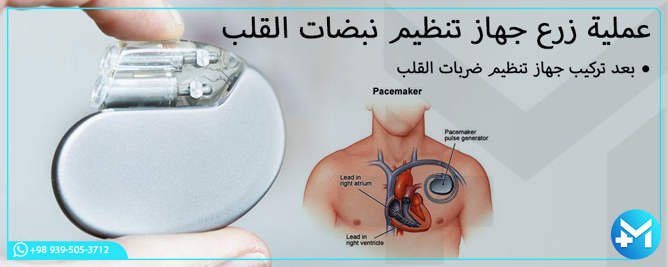 عملية زرع جهاز تنظيم ضربات القلب