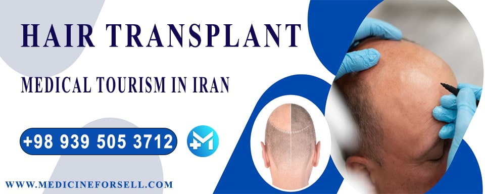 Best Hair Transplant in Iran