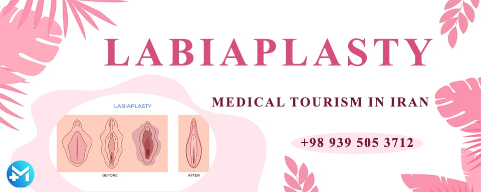 Labiaplasty In Iran